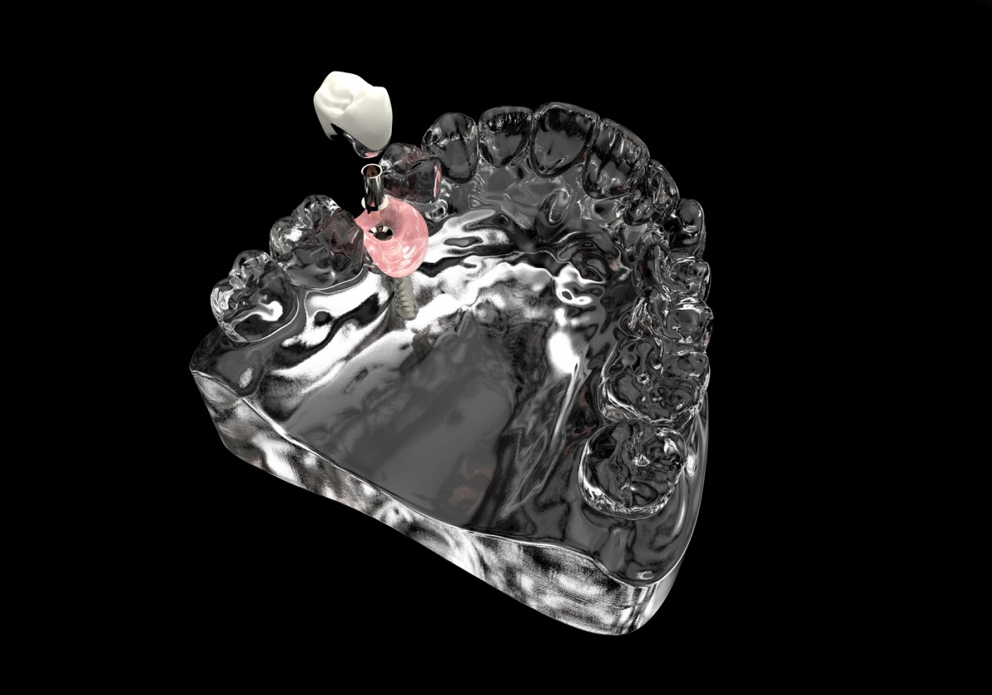 Implanturi dentare Stelidental