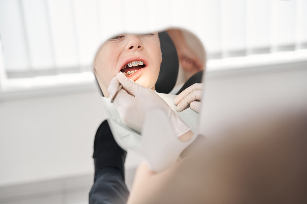 ortodonție Brăila