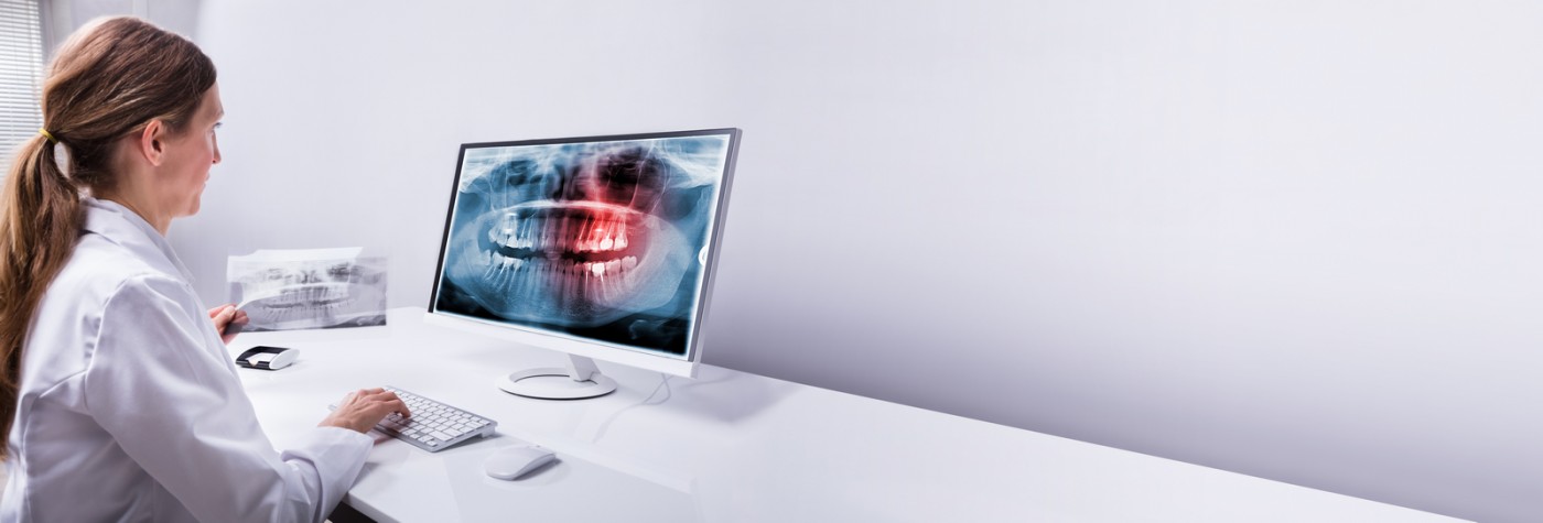 Tipuri principale de radiografii dentare digitale